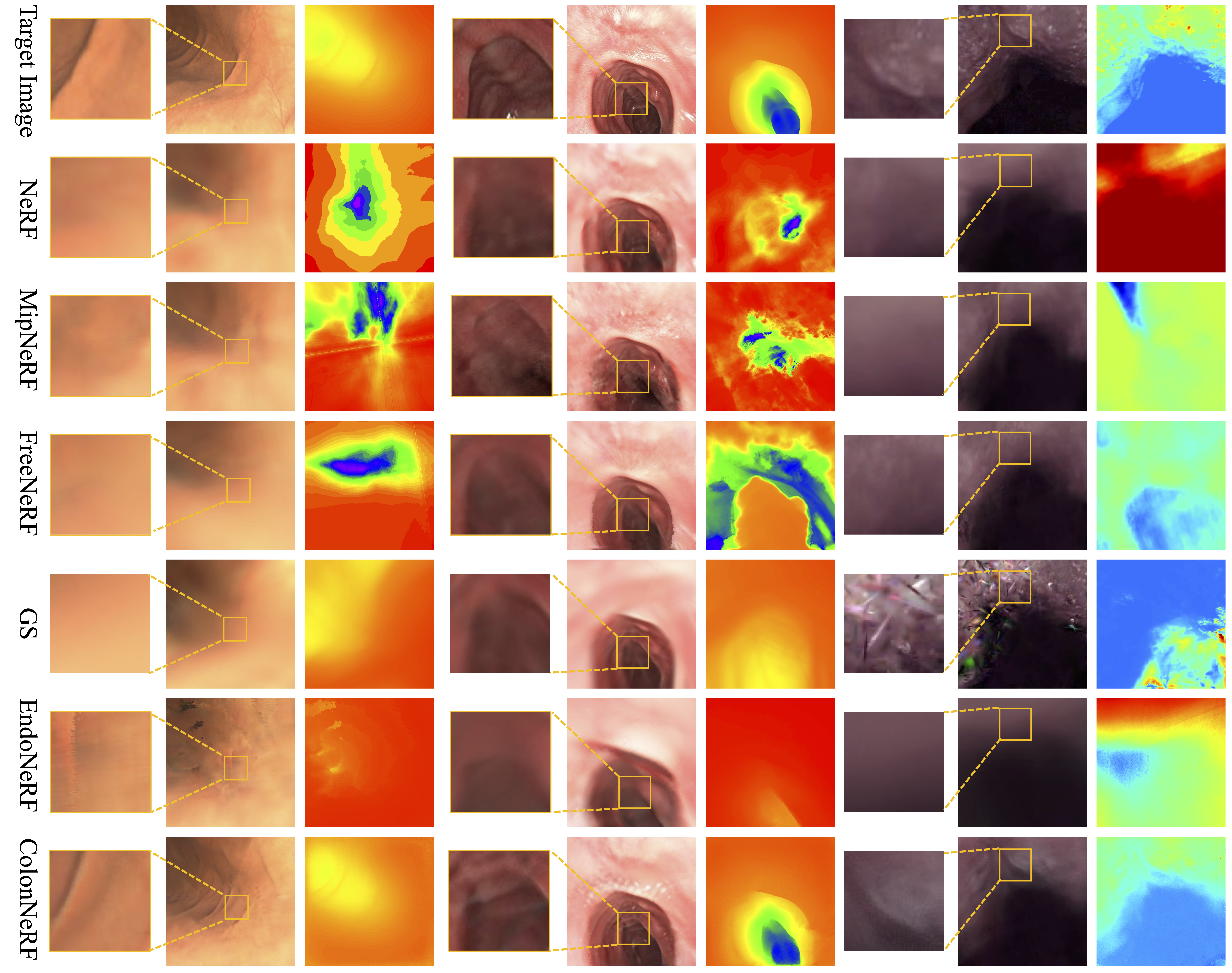 ColonNeRF Comparative Results